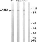 alpha Actinin 2/3 Antibody in Western Blot (WB)