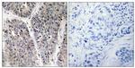 NBL1 Antibody in Immunohistochemistry (Paraffin) (IHC (P))