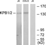 PHKA1/PHKA2 Antibody in Western Blot (WB)