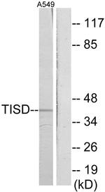TIS11D Antibody in Western Blot (WB)