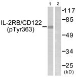 Phospho-CD122 (Tyr364) Antibody in Western Blot (WB)
