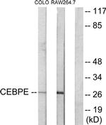 C/EBP delta/epsilon Antibody in Western Blot (WB)