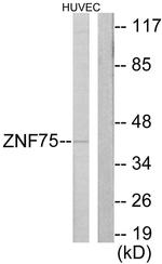 ZNF75D Antibody in Western Blot (WB)