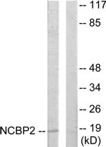 NCBP2 Antibody in Western Blot (WB)