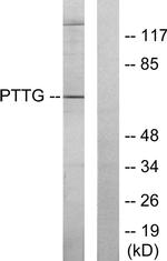PTTG Antibody in Western Blot (WB)