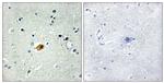 SOX8/SOX9/SOX17/SOX18 Antibody in Immunohistochemistry (Paraffin) (IHC (P))
