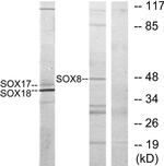 SOX8/SOX9/SOX17/SOX18 Antibody in Western Blot (WB)