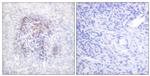 Phospho-Aconitase 1 (Ser138) Antibody in Immunohistochemistry (Paraffin) (IHC (P))