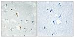 RBM6 Antibody in Immunohistochemistry (Paraffin) (IHC (P))
