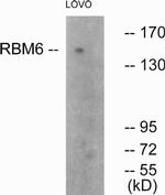 RBM6 Antibody in Western Blot (WB)