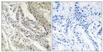 RBP5 Antibody in Immunohistochemistry (Paraffin) (IHC (P))