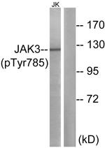 Phospho-JAK3 (Tyr785) Antibody in Western Blot (WB)