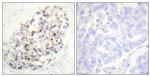 KIF20A Antibody in Immunohistochemistry (Paraffin) (IHC (P))