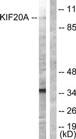 KIF20A Antibody in Western Blot (WB)
