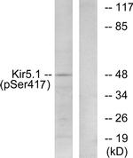 Phospho-Kir5.1 (Ser417) Antibody in Western Blot (WB)