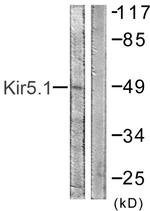 Kir5.1 (KCNJ16) Antibody in Western Blot (WB)