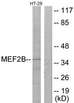 MEF2B Antibody in Western Blot (WB)