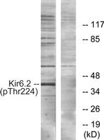 Phospho-Kir6.2 (Thr224) Antibody in Western Blot (WB)