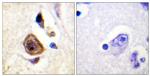 KV3.4 (KCNC4) Antibody in Immunohistochemistry (Paraffin) (IHC (P))