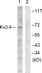 KV3.4 (KCNC4) Antibody in Western Blot (WB)