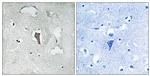 Phospho-KV4.2 (Ser616) Antibody in Immunohistochemistry (Paraffin) (IHC (P))