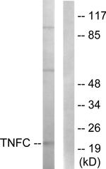 LTB Antibody in Western Blot (WB)
