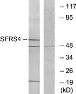 SRSF4 Antibody in Western Blot (WB)