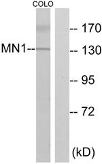 MN1 Antibody in Western Blot (WB)