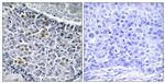 Phospho-MAD1 (Ser428) Antibody in Immunohistochemistry (Paraffin) (IHC (P))
