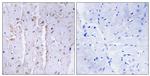 AKAP13 Antibody in Immunohistochemistry (Paraffin) (IHC (P))