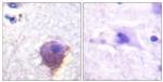 MAP4 Antibody in Immunohistochemistry (Paraffin) (IHC (P))