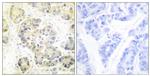 MARK Pan Antibody in Immunohistochemistry (Paraffin) (IHC (P))