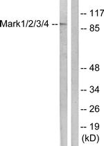 MARK Pan Antibody in Western Blot (WB)