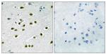 KLF10/KLF11 Antibody in Immunohistochemistry (Paraffin) (IHC (P))