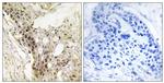 MED21 Antibody in Immunohistochemistry (Paraffin) (IHC (P))