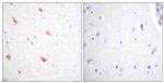 Phospho-NIFK (Thr234) Antibody in Immunohistochemistry (Paraffin) (IHC (P))
