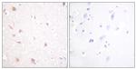 NIFK Antibody in Immunohistochemistry (Paraffin) (IHC (P))