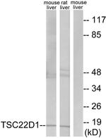 TSC22D1 Antibody in Western Blot (WB)