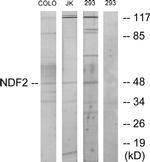NeuroD2 Antibody in Western Blot (WB)