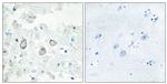 DOK7 Antibody in Immunohistochemistry (Paraffin) (IHC (P))