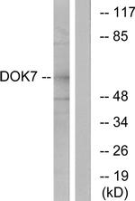 DOK7 Antibody in Western Blot (WB)