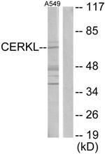 CERKL Antibody in Western Blot (WB)