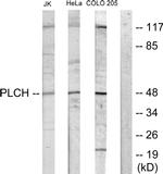 AGPAT9 Antibody in Western Blot (WB)