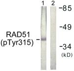 Phospho-RAD51 (Tyr315) Polyclonal Antibody
