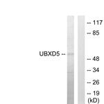 UBXD5 Antibody in Western Blot (WB)