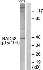 Phospho-RAD52 (Tyr104) Antibody in Western Blot (WB)