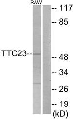TTC23 Antibody in Western Blot (WB)