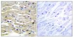Tensin 3 Antibody in Immunohistochemistry (Paraffin) (IHC (P))