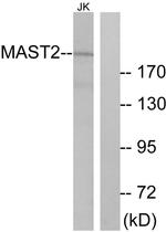 MAST2 Antibody in Western Blot (WB)