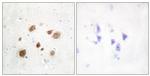 PNCK Antibody in Immunohistochemistry (Paraffin) (IHC (P))